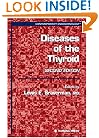 Diseases of the Thyroid (Contemporary Endocrinology)