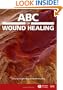 ABC of Wound Healing (ABC Series)