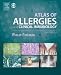 Atlas of Allergies and Clinical Immunology: Textbook with CD-ROM