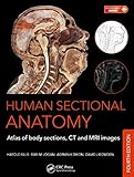 Human sectional anatomy : atlas of body sections, CT and MRI images