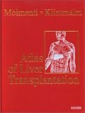 Revue Saunders Book Company  / Atlas of Liver Transplantation