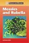 Measles and Rubella (Diseases & Disorders)