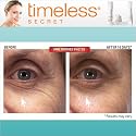 Timeless Secret Anti-Aging Skin Care Kit
