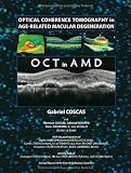 Optical Coherence Tomography in Age-Related Macular Degeneration