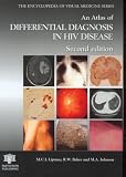 An Atlas of Differential Diagnosis in HIV Disease (Encyclopedia of Visual Medicine Series)