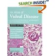 An Atlas of Vulval Diseases: A Combined Dermatological, Gynaecological and Venereological Approach by  Michelle Leibowitch, Richard Staughton, Sallie M. Neill, and Simon Barton