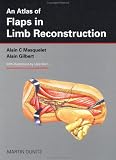 An atlas of flaps in limb reconstruction