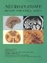 Neuroanatomy : Review for USMLE, Step 1 (NEUROANATOMY ( REV FOR USMLE))