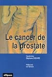 Le cancer de la prostate