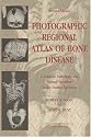 Photographic Regional Atlas Of Bone Disease: A Guide To Pathologic And Normal Variation In The Human Skeleton
