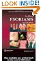 An Atlas of Psoriasis, Second Edition (Encyclopedia of Visual Medicine Series)