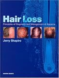 Alopecia: Principles of Diagnosis and Management of Hair Loss