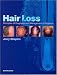   - Hair Loss: Principles of Diagnosis and Management Alopecia