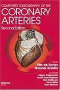 Computed Tomography of the Coronary Arteries