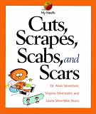Cuts, Scrapes, Scabs, and Scars (My Health)