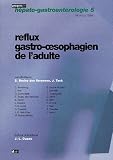 Reflux gastro-oesophagien de l'adulte