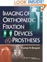 Imaging of Orthopaedic Fixation Devices and Prostheses