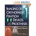 Imaging of Orthopaedic Fixation Devices and Prostheses