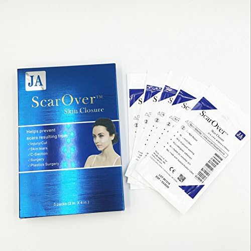 ScarOver Skin Closure - Prevent Scar Formation on Closed Wound (5 sheets / box)