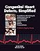 Congenital Heart Defects, Simplified