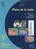 Plaies de la main Plaies de la main