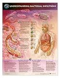 LWW Understanding Bacterial Infections Anatomical Chart Laminated-9774PL1.5