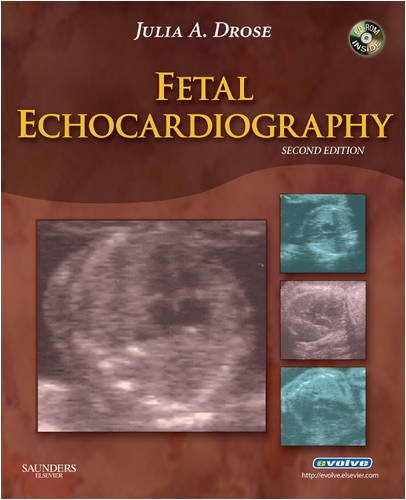 Fetal Echocardiography