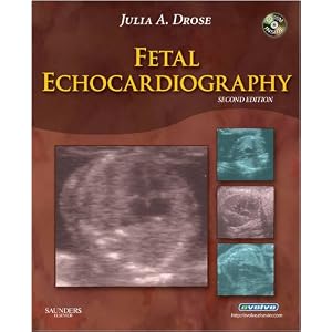 Fetal Echocardiography by Julia A. Drose BA RDMS RDCS RVT