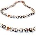The Art of Cure Baltic Amber Teething Necklace (Unisex) (Mosaic) - Anti-inflammatory, Drooling & Teething Pain Reduce Properties - 100% Authentic Certificated Baltic Jewelry with the Highest Quality Guaranteed. Easy to Fastens with a Twist-in Screw Clasp Mothers Approved Remedies!