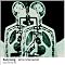 Listen to some Radiohead, the head of the proverbial radio