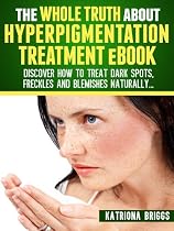 The Whole Truth about Hyperpigmentation Treatment eBook: Discover How to Treat Dark Spots, Freckles and Blemishes Naturally-From Free Kindle Books Library