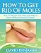 How To Get Rid Of Moles How To Get Rid Of Moles