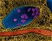 Wallmonkeys Peel and Stick Wall Decals - Bacillus Anthracis Spores in Lung Bronchiole - Removable Gr