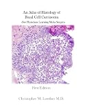 An Atlas of Histology of Basal Cell Carcinoma (For Physicians Learning Mohs Surgery)