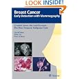 Crushed Stone-like Calcifications: The Most Frequent Malignant Type (Breast Cancer - Early... by Laszlo Tabar, Tibor Tot, and Peter Dean