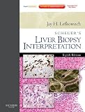 Scheuer's Liver Biopsy Interpretation: Expert Consult: Online and Print