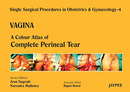 A Colour Atlas of Complete Perineal Tear (Volume 4) (Single Surgical Procedures in Obstetrics & Gynaecology)