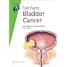 Bladder Cancer (Fast Facts)