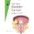 Bladder Cancer (Fast Facts)