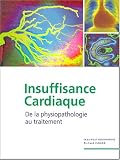 Insuffisance cardiaque