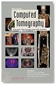Computed Tomography