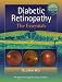 Diabetic Retinopathy: The Essentials