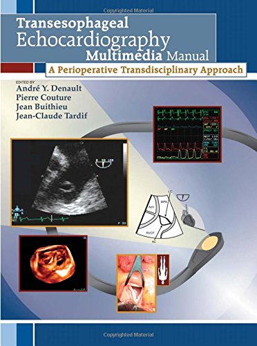 Transesophageal Echocardiography Multimedia Manual, first edition: A Perioperative Transdisciplinary Approach (Book + DVD)