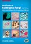 Identification of Pathogenic Fungi