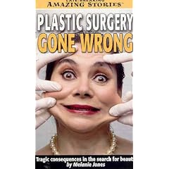 Plastic Surgery Gone Wrong