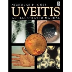 Uveitis: An Illustrated Manual by Nicholas Jones FRCS  FRCOphth and Nicholas P. Jones