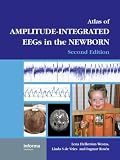 An Atlas of Amplitude-Integrated EEGs in the Newborn, Second Edition, with DVD (ENCYCLOPEDIA OF VISUAL MEDICINE SERIES)