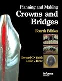 Planning and making crowns and bridges