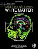 MRI Atlas of Human White Matter, Second Edition