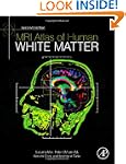 MRI Atlas of Human White Matter